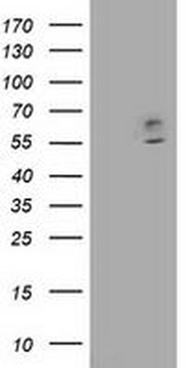 CNDP1 Antibody in Western Blot (WB)