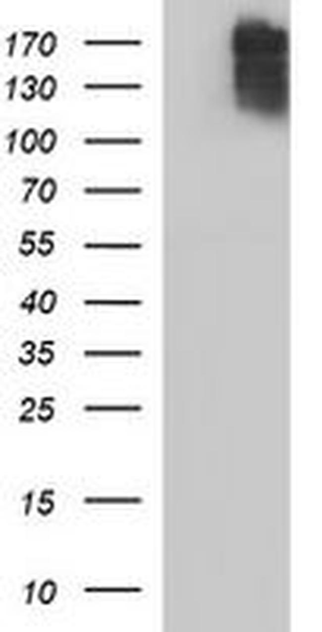 COL15A1 Antibody in Western Blot (WB)