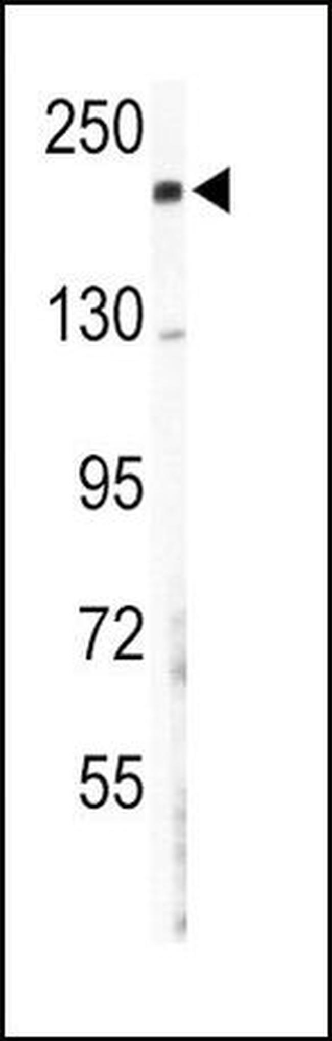COL5A2 Antibody in Western Blot (WB)