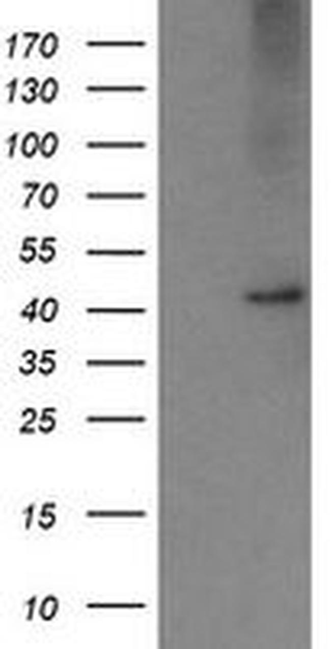 CPA2 Antibody in Western Blot (WB)