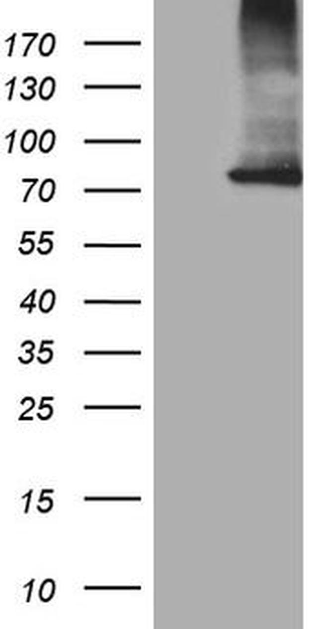CPT1B Antibody in Western Blot (WB)