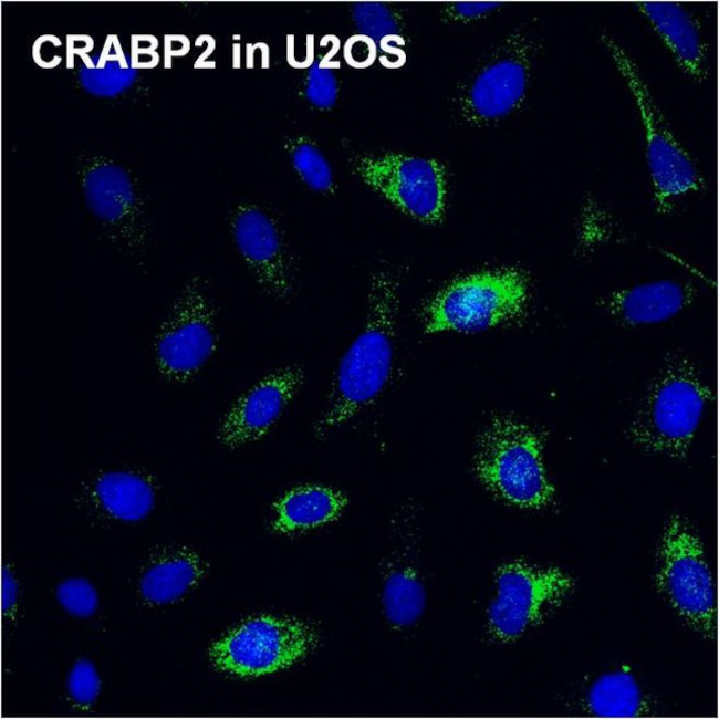 CRABP2 Antibody in Immunocytochemistry (ICC/IF)