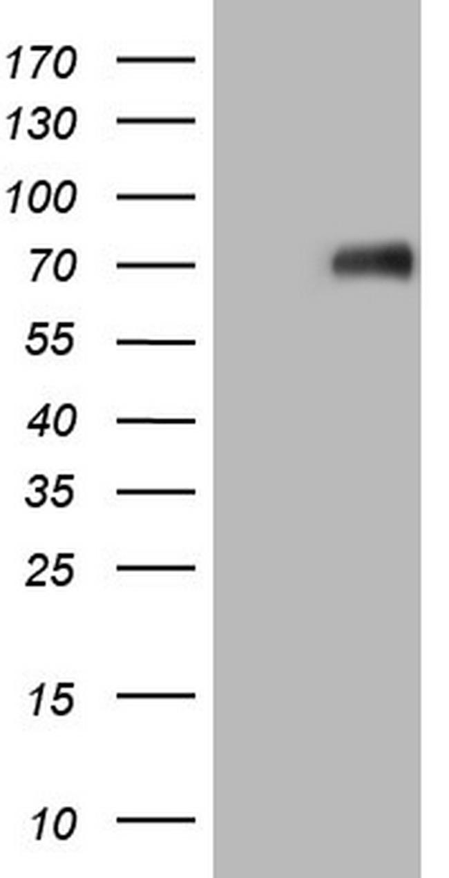 CSF1 Antibody in Western Blot (WB)