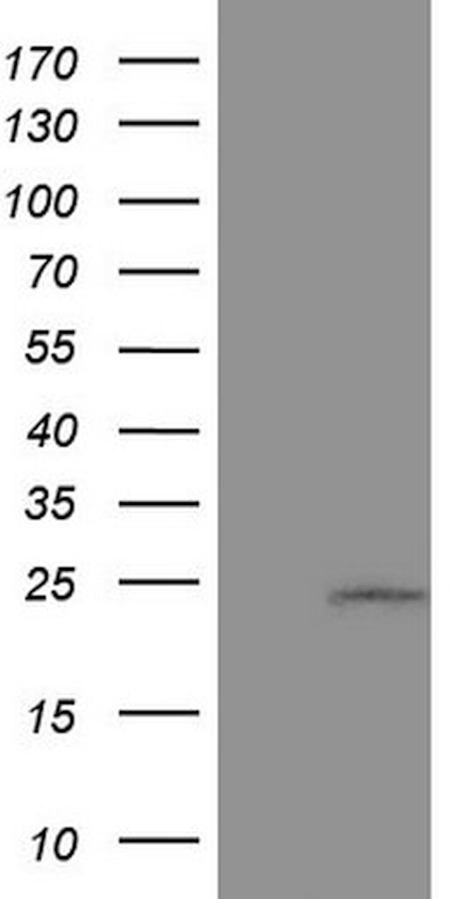 CSF3 Antibody in Western Blot (WB)