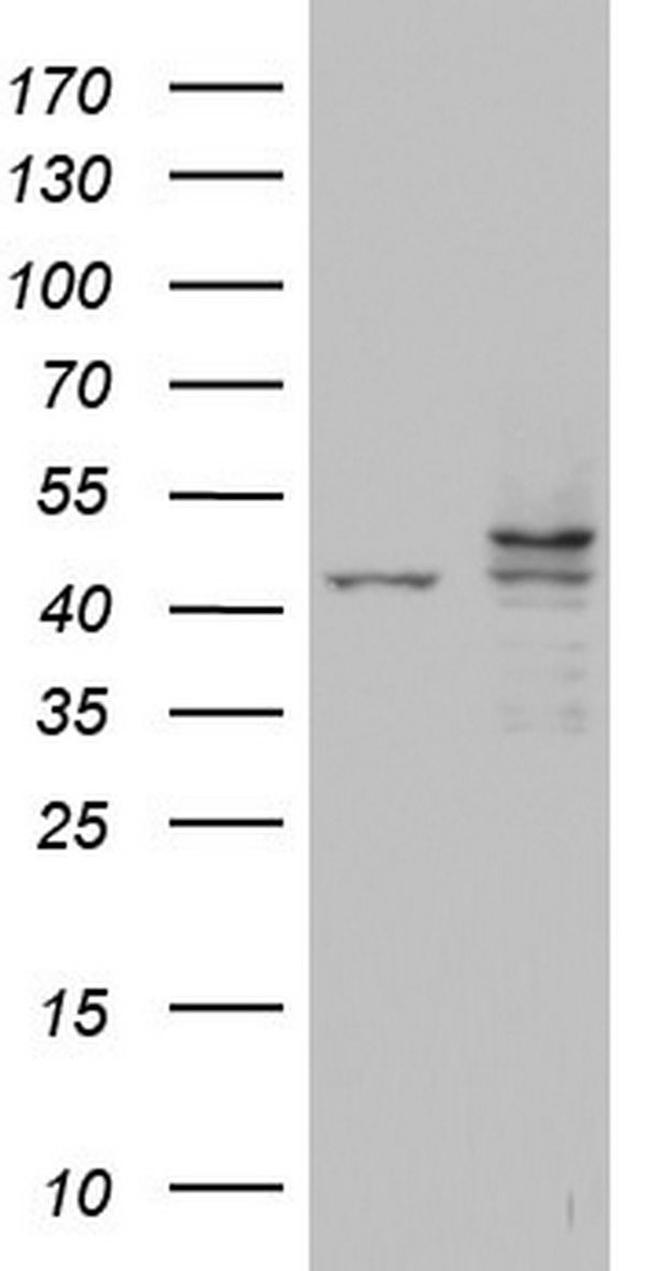 CSNK1E Antibody in Western Blot (WB)