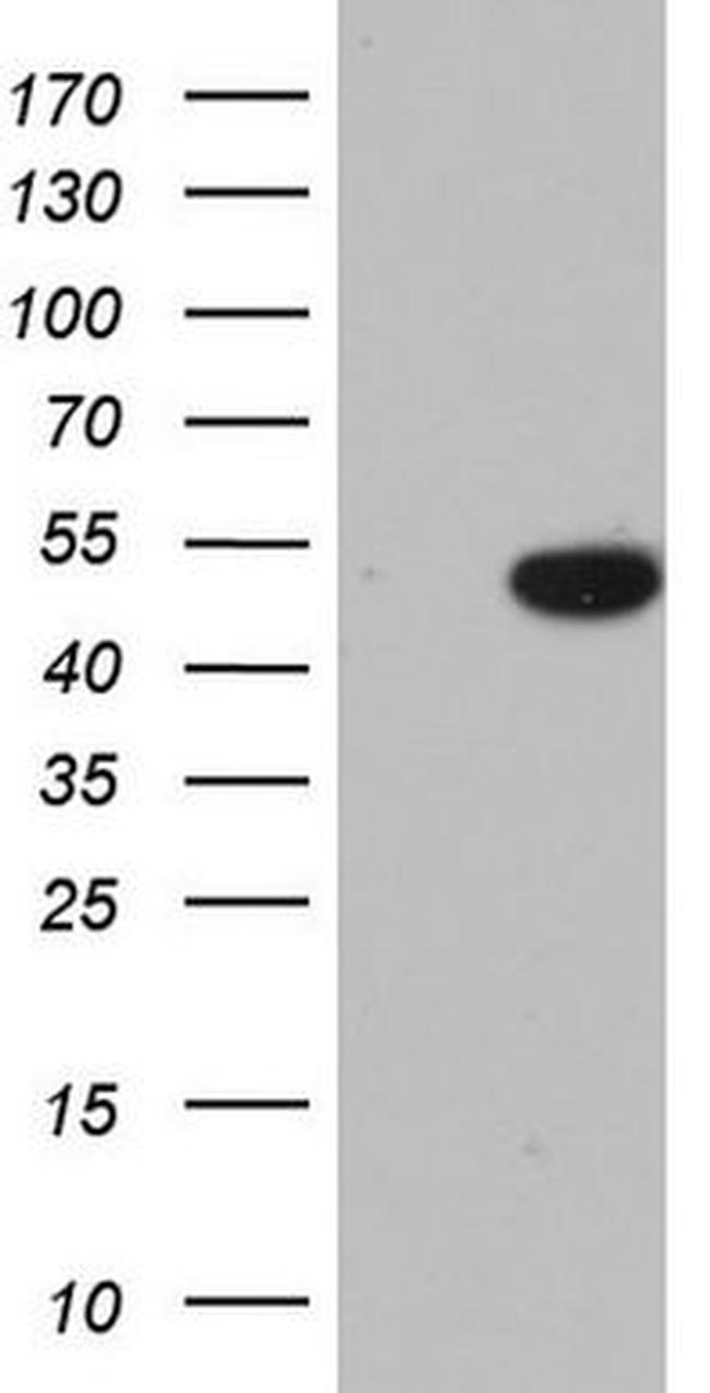 CSNK1G2 Antibody in Western Blot (WB)