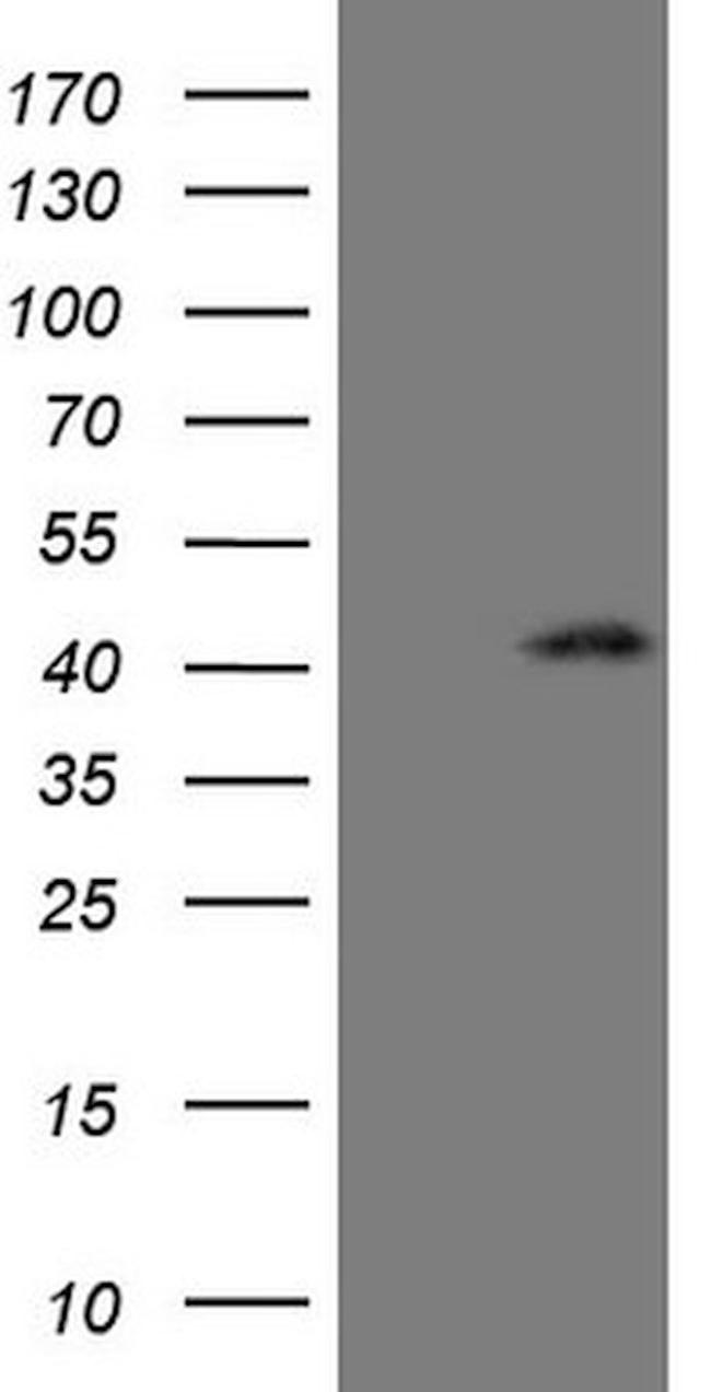 CTGF Antibody in Western Blot (WB)