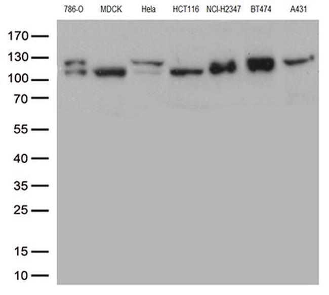 CTNND1 Antibody in Western Blot (WB)