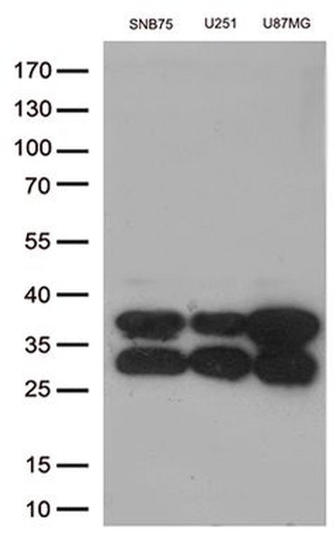 CTSL1 Antibody in Western Blot (WB)