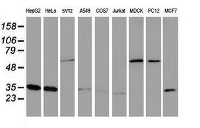 CYB5R3 Antibody in Western Blot (WB)