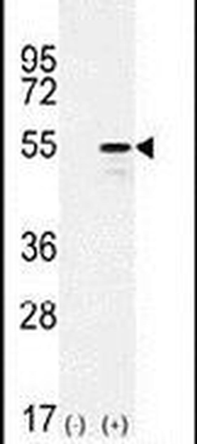CYP26B1 Antibody in Western Blot (WB)