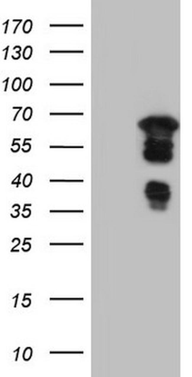DBNL Antibody in Western Blot (WB)