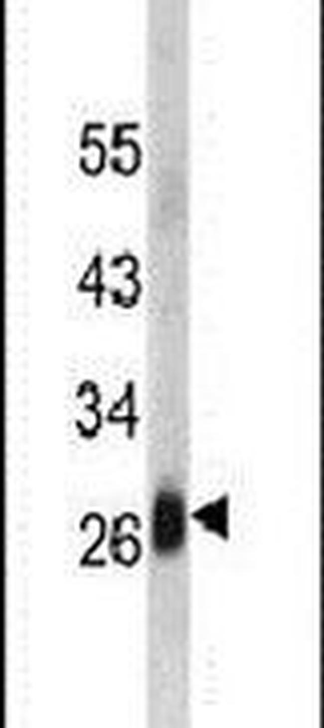 DCL-1 Antibody in Western Blot (WB)