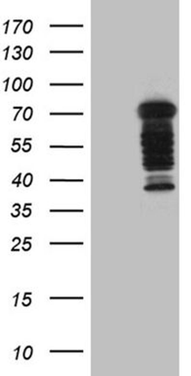DCP1B Antibody in Western Blot (WB)