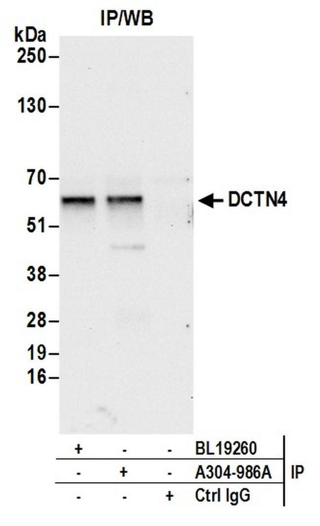 DCTN4/Dynactin p62 Antibody in Western Blot (WB)