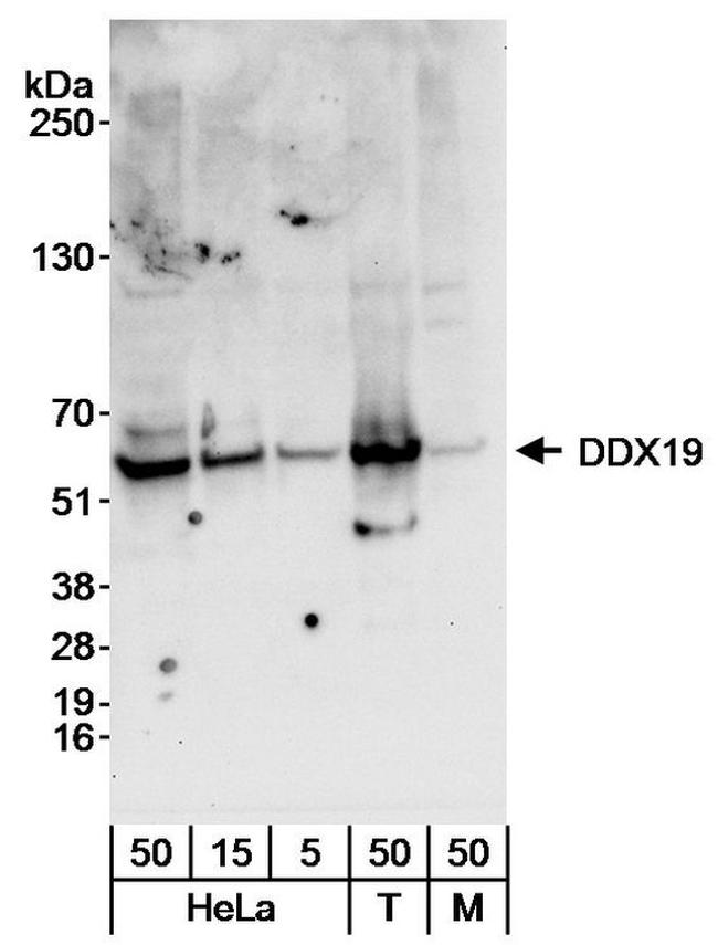 DDX19 Antibody in Western Blot (WB)
