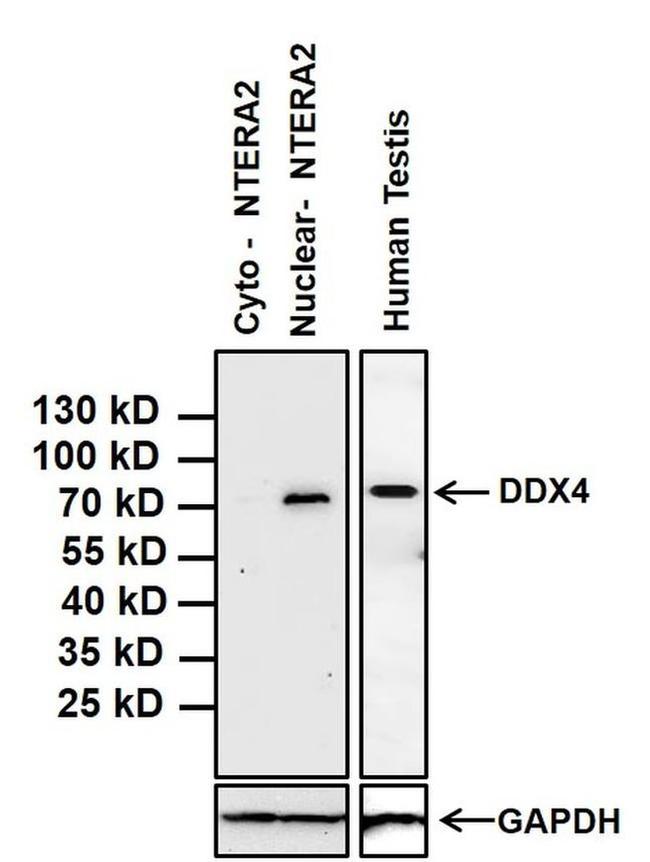 DDX4 Antibody in Western Blot (WB)