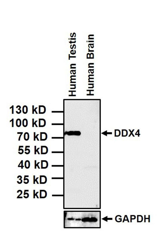 DDX4 Antibody in Western Blot (WB)