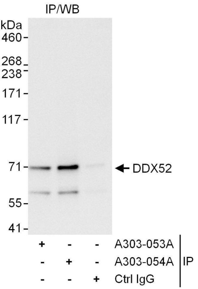 DDX52 Antibody in Immunoprecipitation (IP)
