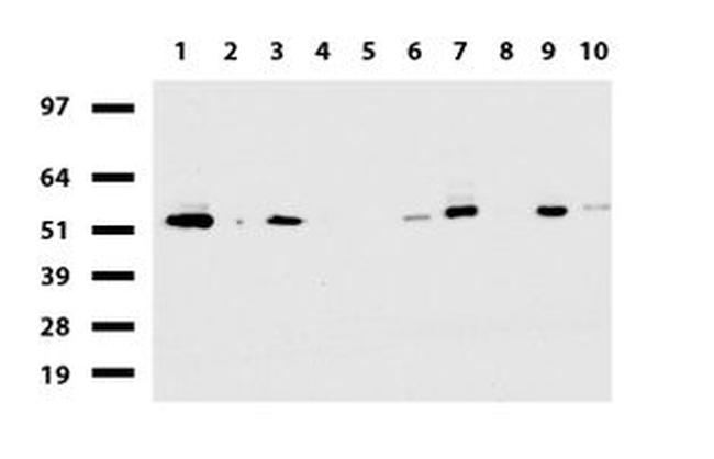 DDX56 Antibody in Western Blot (WB)