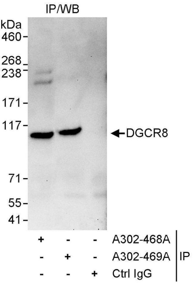DGCR8 Antibody in Immunoprecipitation (IP)