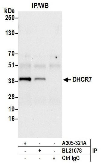 DHCR7 Antibody in Immunoprecipitation (IP)
