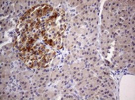 DICER1 Antibody in Immunohistochemistry (Paraffin) (IHC (P))