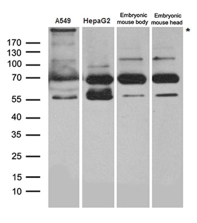 DICER1 Antibody in Western Blot (WB)