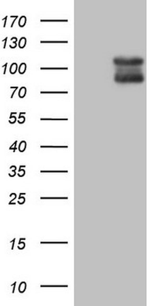 DLG4 Antibody in Western Blot (WB)