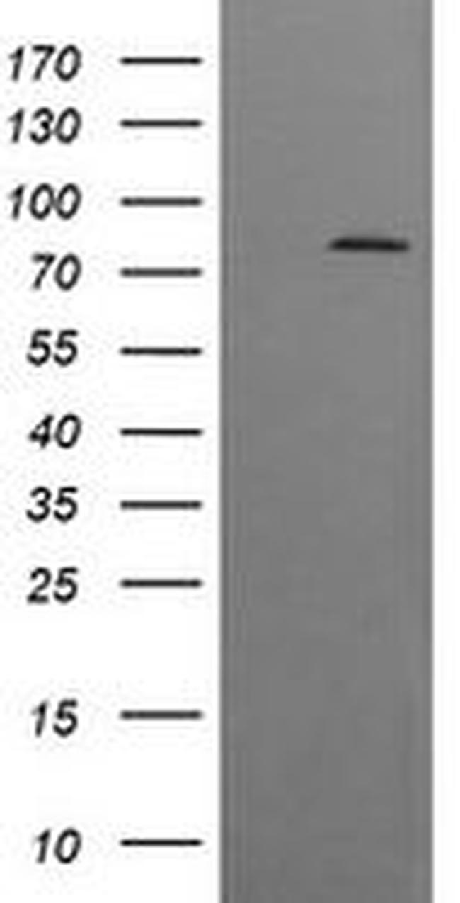 DNM1L Antibody in Western Blot (WB)