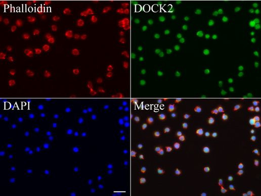 DOCK2 Antibody in Immunocytochemistry (ICC/IF)