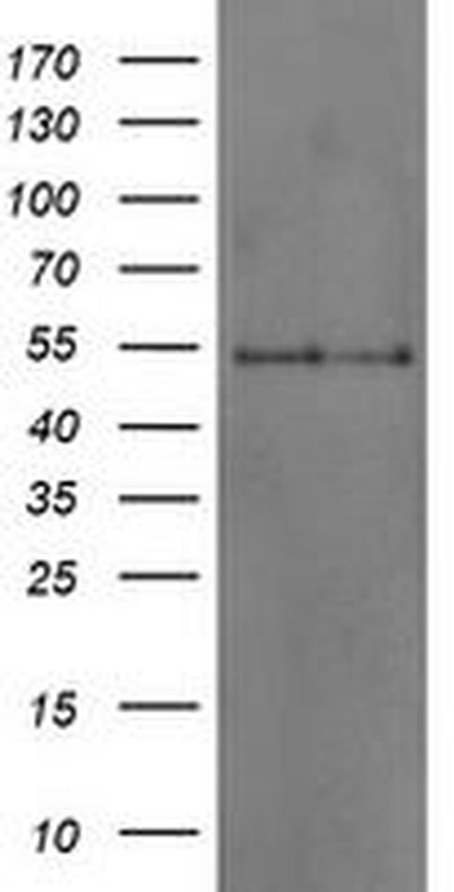 DOK7 Antibody in Western Blot (WB)