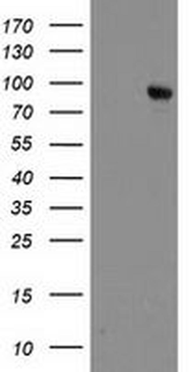 DPP10 Antibody in Western Blot (WB)
