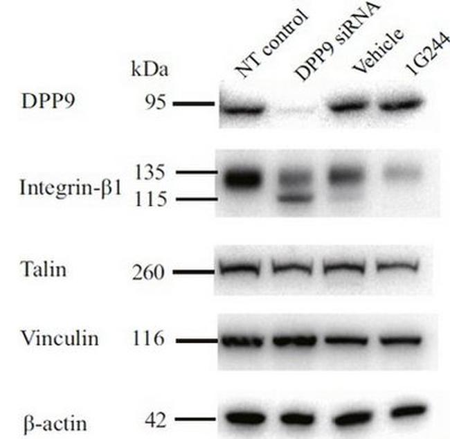 DPP9 Antibody in Western Blot (WB)