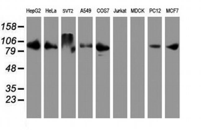 DPP9 Antibody in Western Blot (WB)