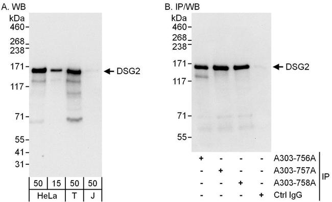 DSG2 Antibody in Western Blot (WB)
