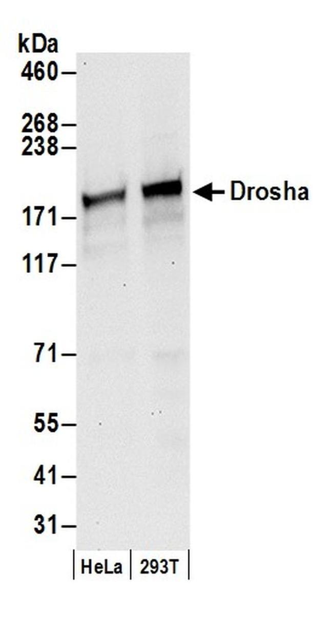 Drosha Antibody in Western Blot (WB)
