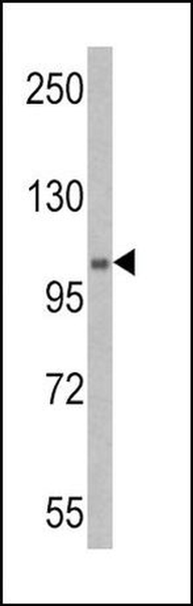 UBE1 Antibody in Western Blot (WB)
