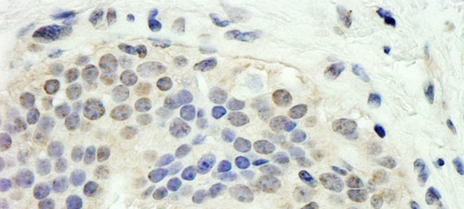E2F1 Antibody in Immunohistochemistry (IHC)