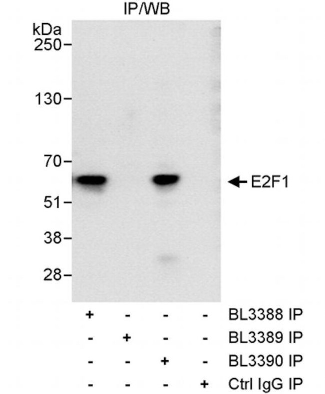 E2F1 Antibody in Immunoprecipitation (IP)