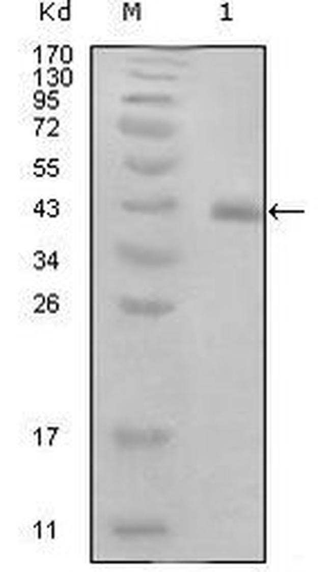 HPV Type 16 E7 Antibody in Western Blot (WB)