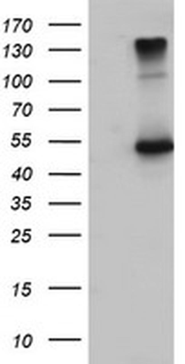 EFEMP1 Antibody in Western Blot (WB)