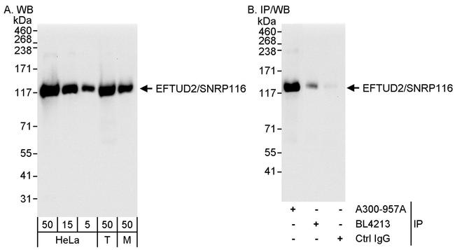 EFTUD2/SNRP116 Antibody in Western Blot (WB)