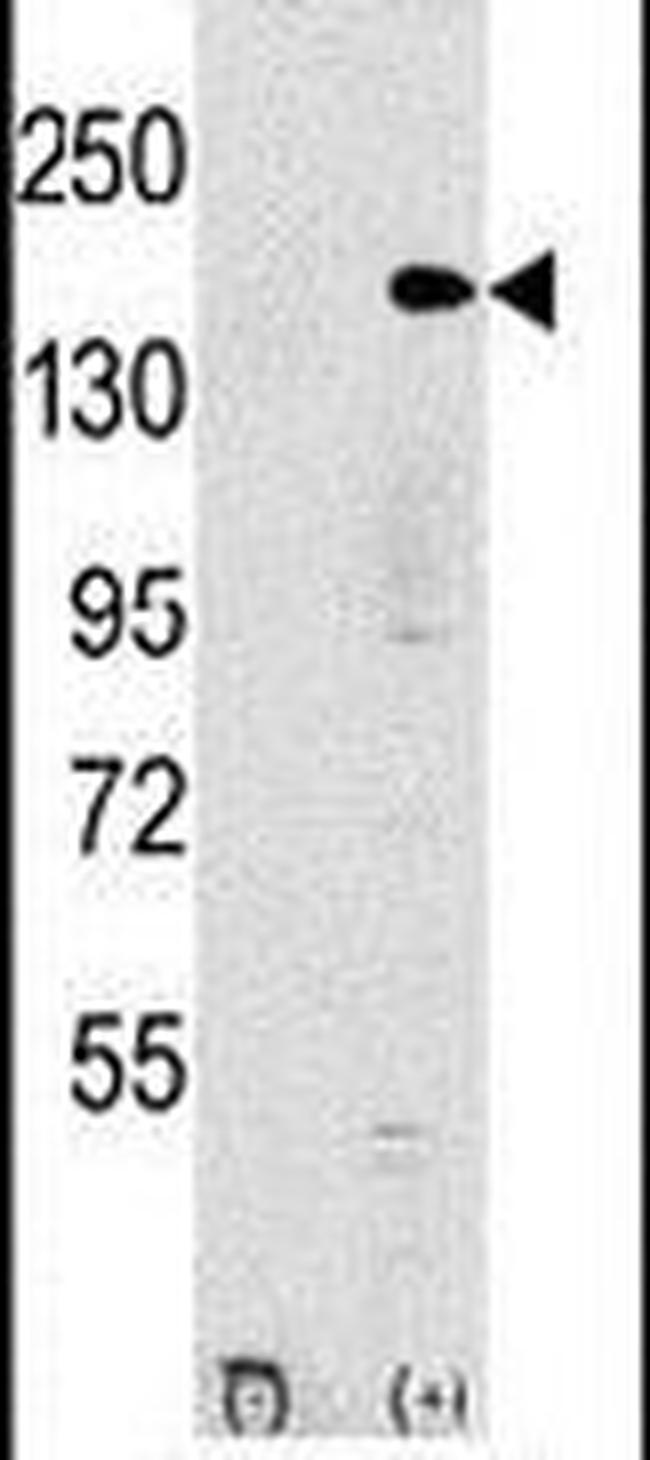 EHMT1 Antibody in Western Blot (WB)