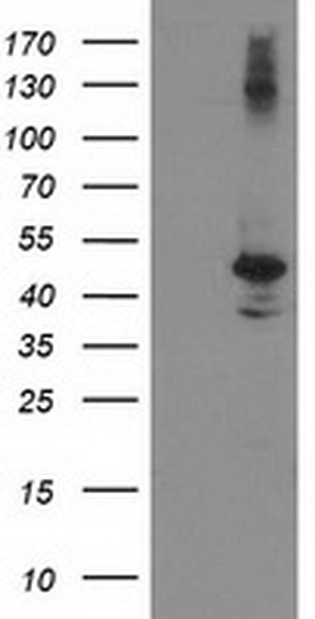 EIF2B3 Antibody in Western Blot (WB)