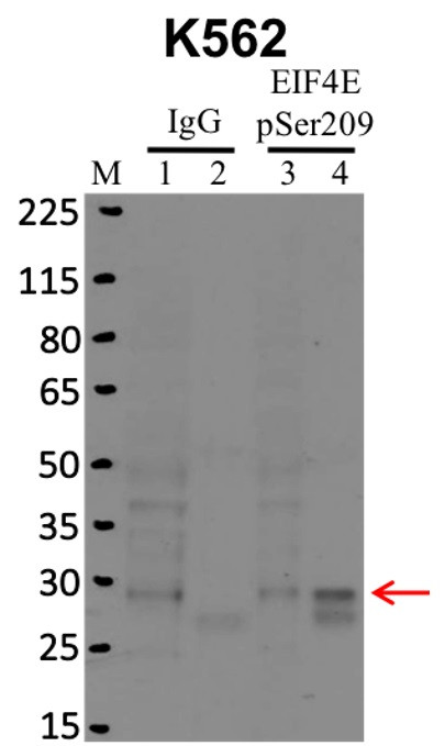Phospho-eIF4E (Ser209) Antibody in Immunoprecipitation (IP)