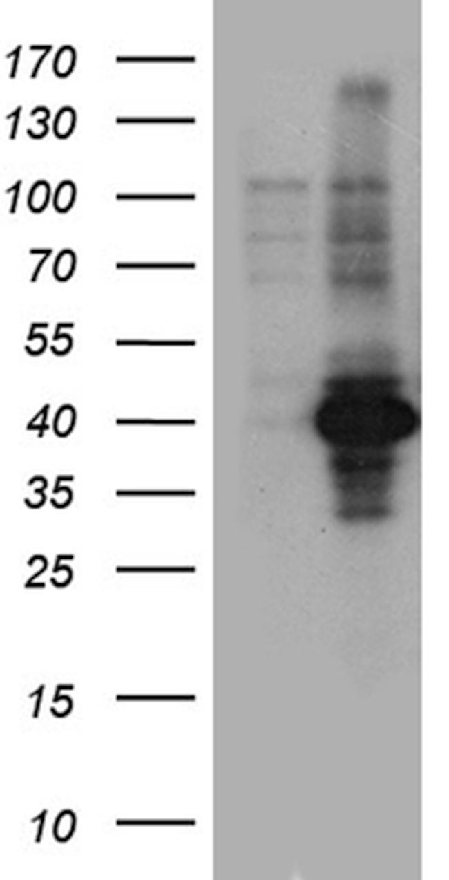 EME2 Antibody in Western Blot (WB)