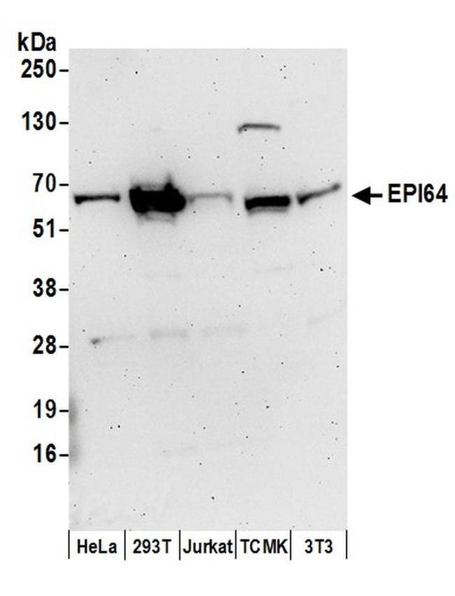 EPI64 Antibody in Western Blot (WB)