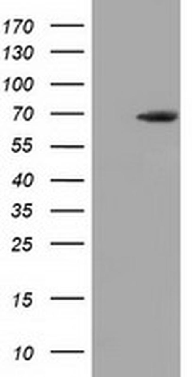 EPM2AIP1 Antibody in Western Blot (WB)