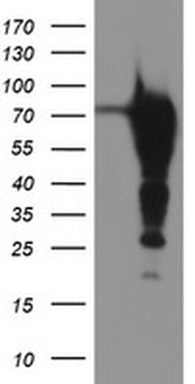 EPN2 Antibody in Western Blot (WB)